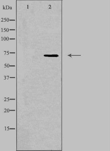 SCNN1D Antibody