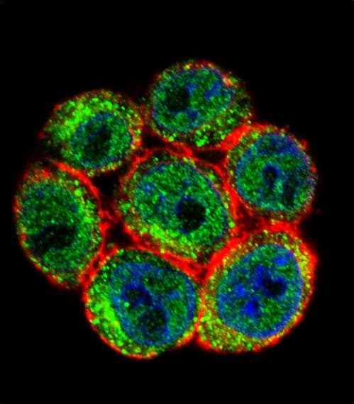 Polyclonal Rabbit anti-Human SSH3 Antibody (aa575-602, IHC, IF, WB)