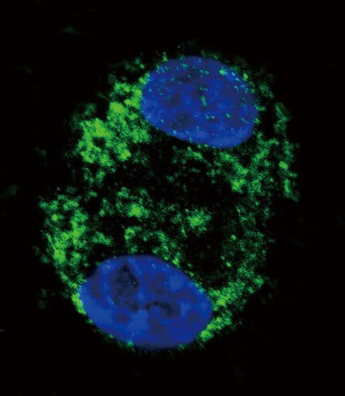 Polyclonal Rabbit anti-Human CPT2 Antibody (aa431-462, IF, WB)