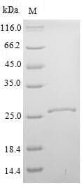 Mouse KLK14 / Kallikrein 14 Protein (Recombinant 6His, N-terminus)
