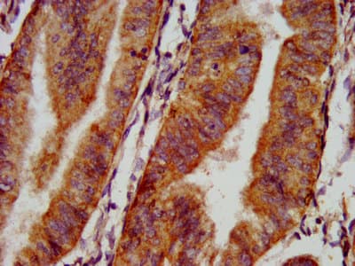 Polyclonal Rabbit anti-Human NPHP4 Antibody (IHC, IF)