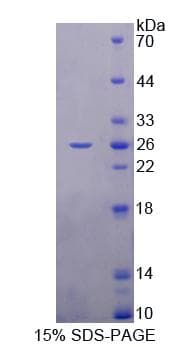 Rat RBP3 / IRBP Protein (Recombinant His-T7)