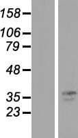 TMPRSS3 Protein (Over-Expression Lysate Myc-DDK (Flag))
