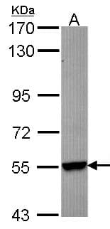 IHC-plus™ CYP26B1 Antibody
