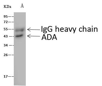 ADA / Adenosine Deaminase Antibody