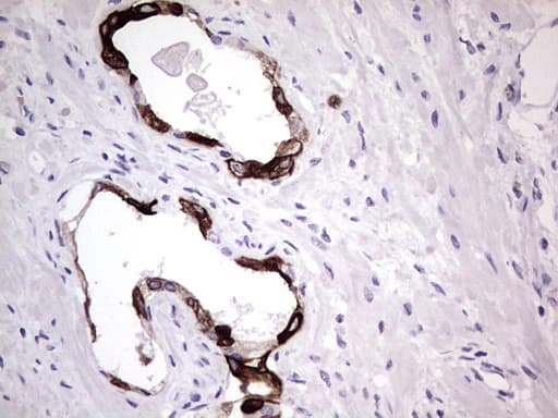Monoclonal Mouse anti-Human KRT19 / CK19 / Cytokeratin 19 Antibody (clone OTI1F5, aa240-390, IHC, WB)