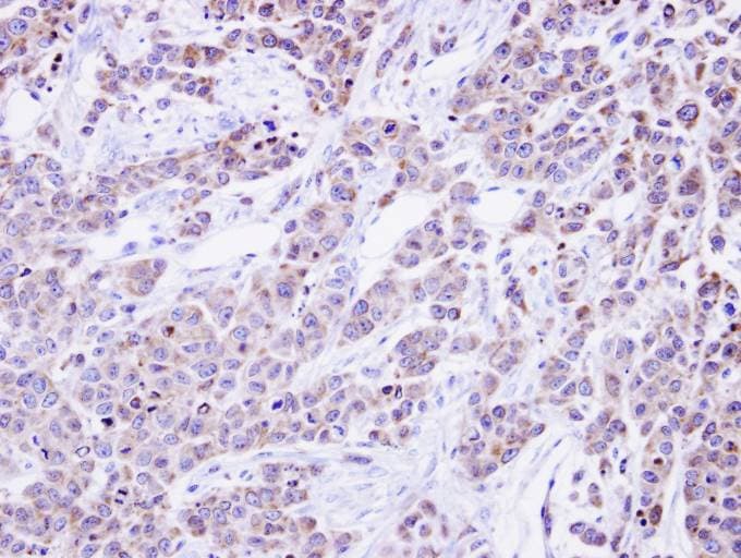 GANAB / Alpha Glucosidase II Antibody (aa654-944)