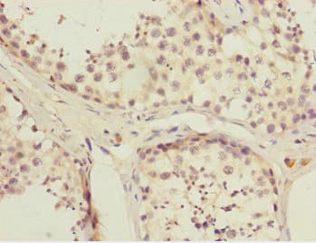 Polyclonal Rabbit anti-Human FAM48A / P38IP Antibody (IHC, WB)