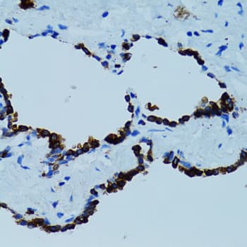 Polyclonal Rabbit anti-Human CTSE / Cathepsin E Antibody (IHC, IF, WB)