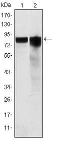 GYS1 / Glycogen Synthase Antibody (clone 3A7)