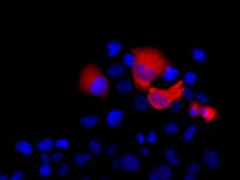 Monoclonal Mouse anti-Human SHH / Sonic Hedgehog Antibody (clone OTI3A2, IF, WB)