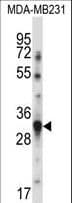 BAFF / TNFSF13B Antibody (aa16-44)