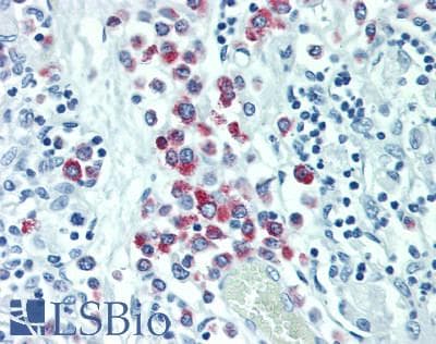 IHC-plus™ Polyclonal Rabbit anti-Human CEP131 / AZI1 Antibody (280-360 aa, Internal, IHC, WB)
