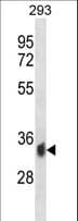 PPP6C Antibody (aa264-293)