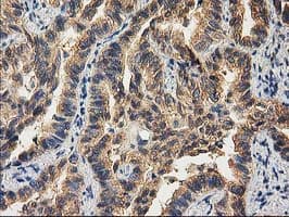 CHCHD5 Antibody (clone OTI9E6)