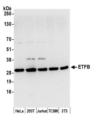 ETFB Antibody (aa205-255)