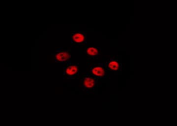 Polyclonal Rabbit anti-Human Histone H3.1 Antibody (phospho-Ser10, IHC, WB)