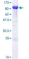 Human Ubiquilin 2 / UBQLN2 Protein (Recombinant GST)
