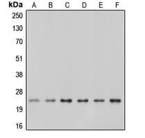 PathPlus™ CAV1 / Caveolin 1 Antibody (C-Terminus)