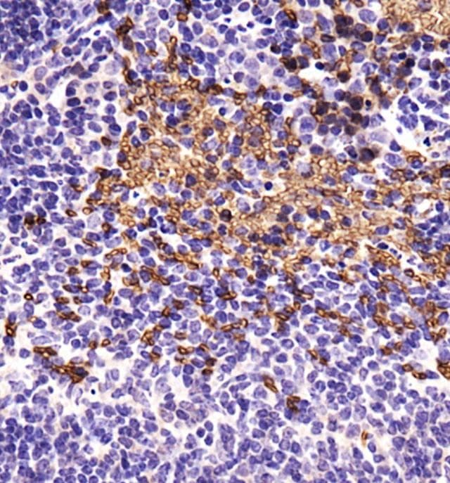 NIP3 / BNIP3 Antibody (Biotin)