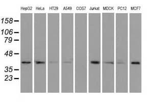 ACAT2 Antibody (clone OTI5A2)