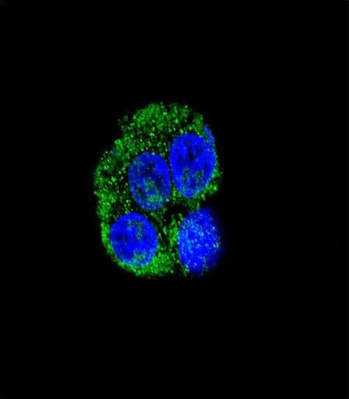 CD36 Antibody (aa213-242)