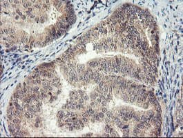 MEIS3 Antibody (aa1-261, clone OTI2E12, Carrier-free)
