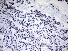CD5 Antibody (clone OTI10F4)