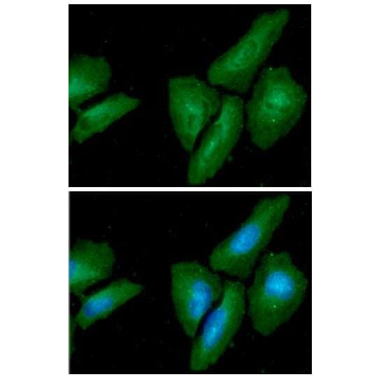 LAMTOR3 / MP1 Antibody (clone AT1F10)
