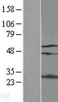 GATAD2A Protein (Over-Expression Lysate Myc-DDK (Flag))