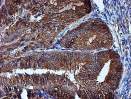 IDS / Iduronate 2 Sulfatase Antibody (clone OTI4G2)