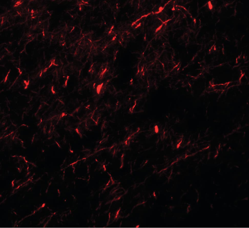 IHC-plus™ APBA1 / MINT1 Antibody