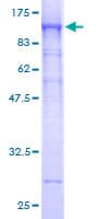 Human GOK / STIM1 Protein (Recombinant GST)