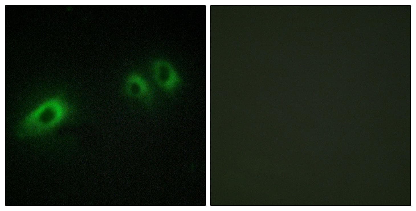 LAMB1 / Laminin Beta 1 Antibody