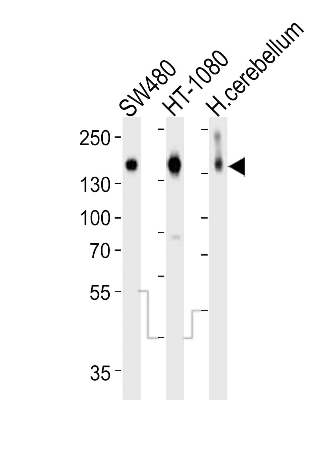 NCAM / CD56 Antibody (aa796-830)