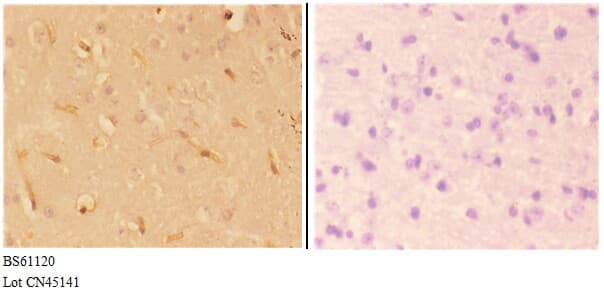 Polyclonal Rabbit anti-Human ABHD4 Antibody (IHC, WB)