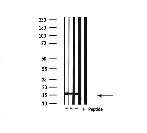 UBE2D2 / UBCH5B Antibody