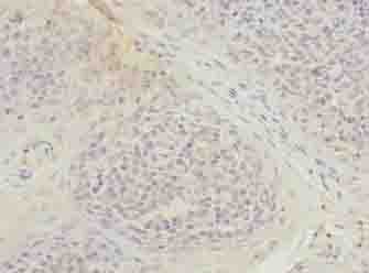 Polyclonal Rabbit anti-Human TUBB1 / Tubulin Beta 1 Antibody (IHC, WB)