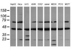 MAP2K1 / MKK1 / MEK1 Antibody (clone OTI2G5, Carrier-free)