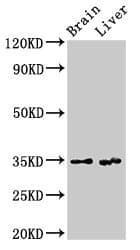 RBKS / Ribokinase Antibody