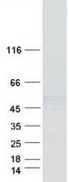 Human NDUFS2 Protein (Recombinant Myc-DDK (Flag))