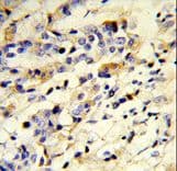 Rabbit Anti-Human IgM Secondary Antibody