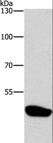 Polyclonal Rabbit anti-Human CTBP1 / CTBP Antibody (IHC, WB)