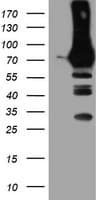 PFKP Antibody (clone OTI2E10)