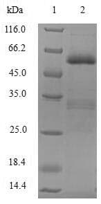 Human SIAH1 Protein (Recombinant GST, N-terminus)