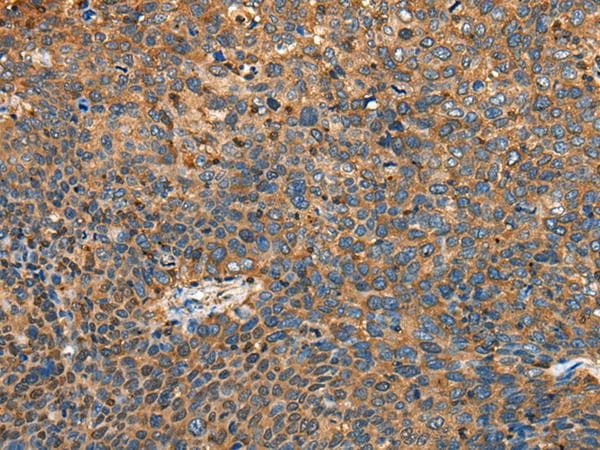 Polyclonal Rabbit anti-Human MRLC2 / MYL12B Antibody (IHC, WB)