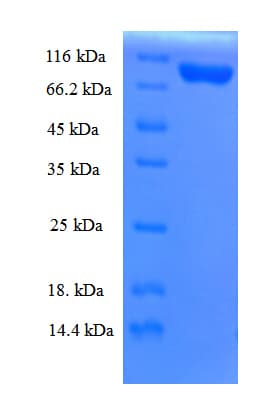 Mouse KPNB1 / Importin Beta Protein (Recombinant His)