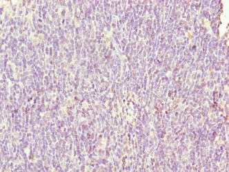 SH3BGRL3 Antibody