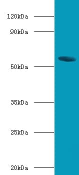 NR1H4 / FXR Antibody