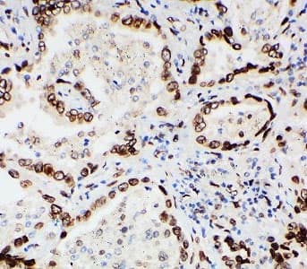 LMNA / Lamin A+C Antibody (aa455-469)